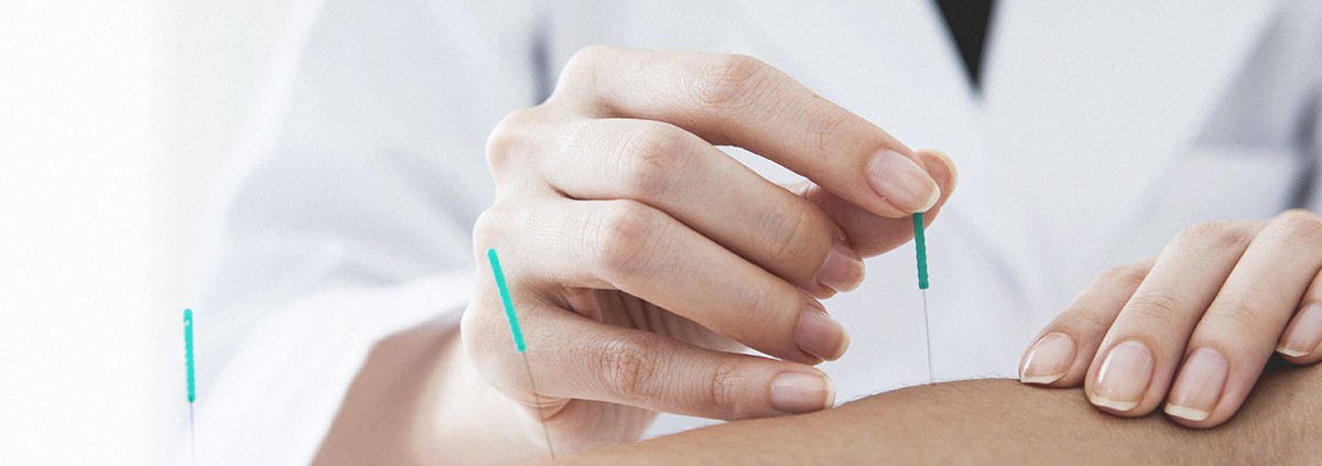 Dry Needling Trigger Point Points Dry needling terapie ace - ce este, cum funcționează, doare, efecte, beneficii, contraindicatii, tratament, recuperare