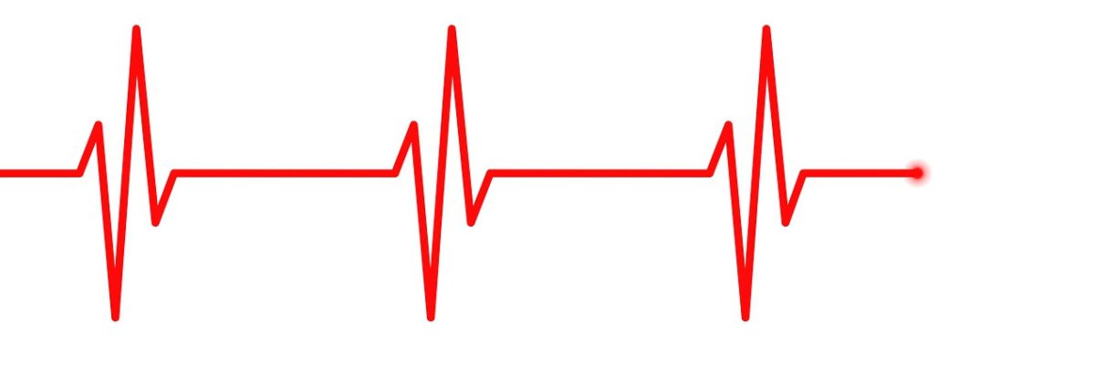 Electrocardiograma ECG EKG - ce este, la ce ajută, cum se face, pregatire, diagnostic, boli, afectiuni