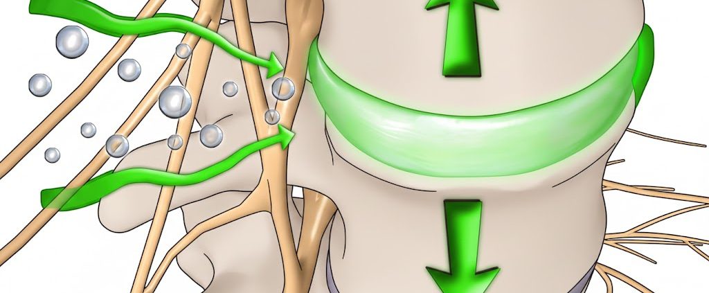 Elongații Vertebrale Decompresie Vertebrală - ce este, beneficii, indicații