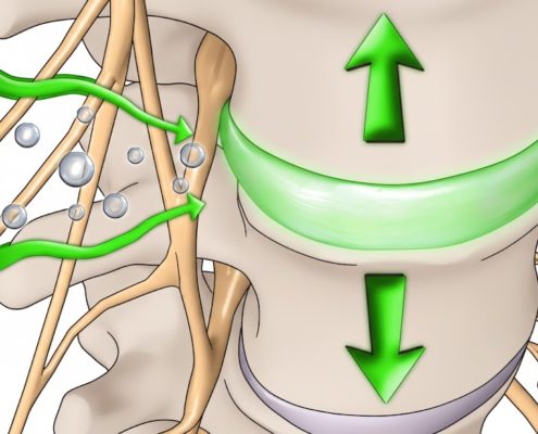 Elongații Vertebrale Decompresie Vertebrală - ce este, beneficii, indicații