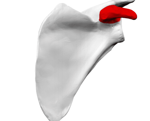 Fractura de proces coracoid