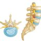 Hernie de disc Hernia de disc - ce este, simptome, clasificare, cauze, diagnostic, tratament, investigații, recuperare, masaj, fizioterapie, kinetoterapie, plasturi, calmante, operatie, medicamente, pastile, bucuresti, tipuri, ceai, recidiva, calmante, unguent