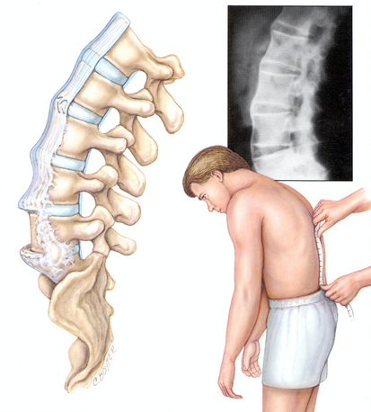 dureri articulare la baza piciorului mare unguent pentru refacerea cartilajului coloanei vertebrale