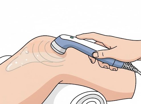 Terapia cu ultrasunete - ce este, beneficii, efecte, indicații, contraindicații