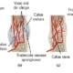 Vindecarea oaselor fracturii fractura calus calusul calusului osos Vindecarea oaselor / fracturii sau formarea calusului