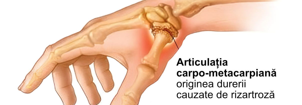 ceea ce face durerea articulației pe deget